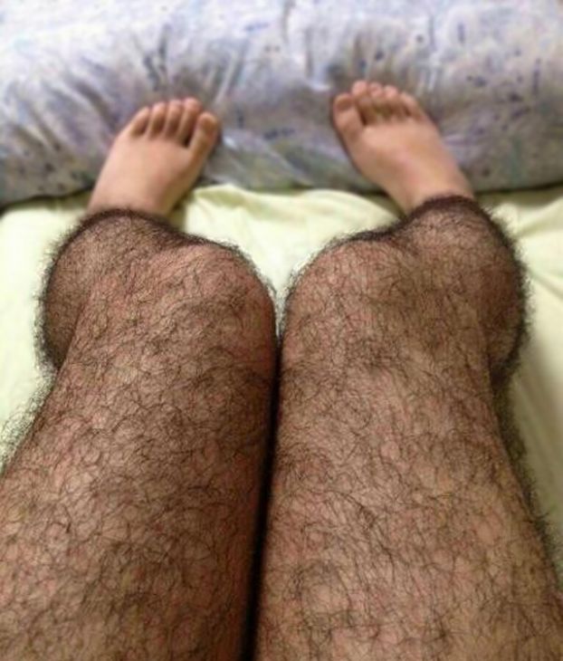 Hairy stockings