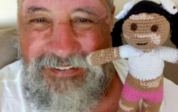 Um avô com bonecas de malha com vitiligo para restaurar autoestima de crianças com esta doença 