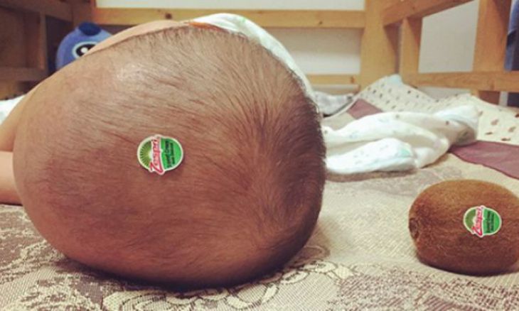 Când capul bebeluşului arată ca un fruct de kiwi…