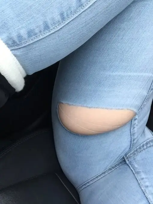 Grande buraco nas calças