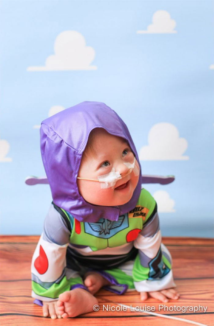 Uma criança com síndrome de Down olha para cima