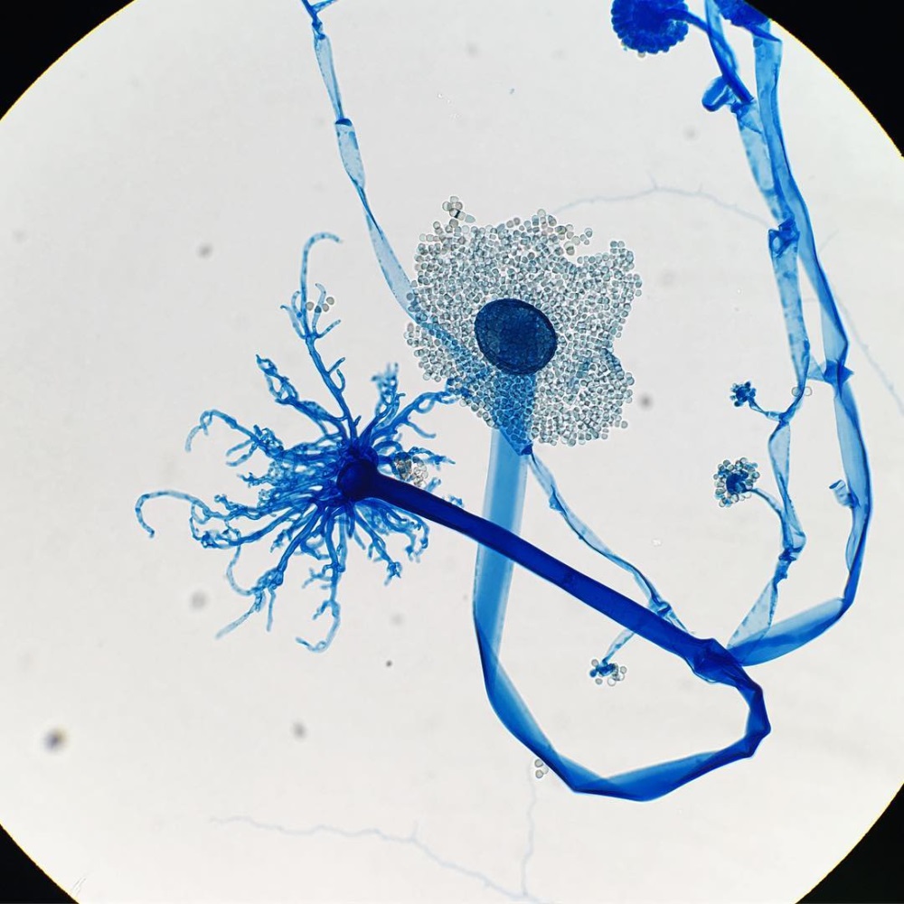 Los hongos Syncephalastrum lucen como flores bajo el microscopio