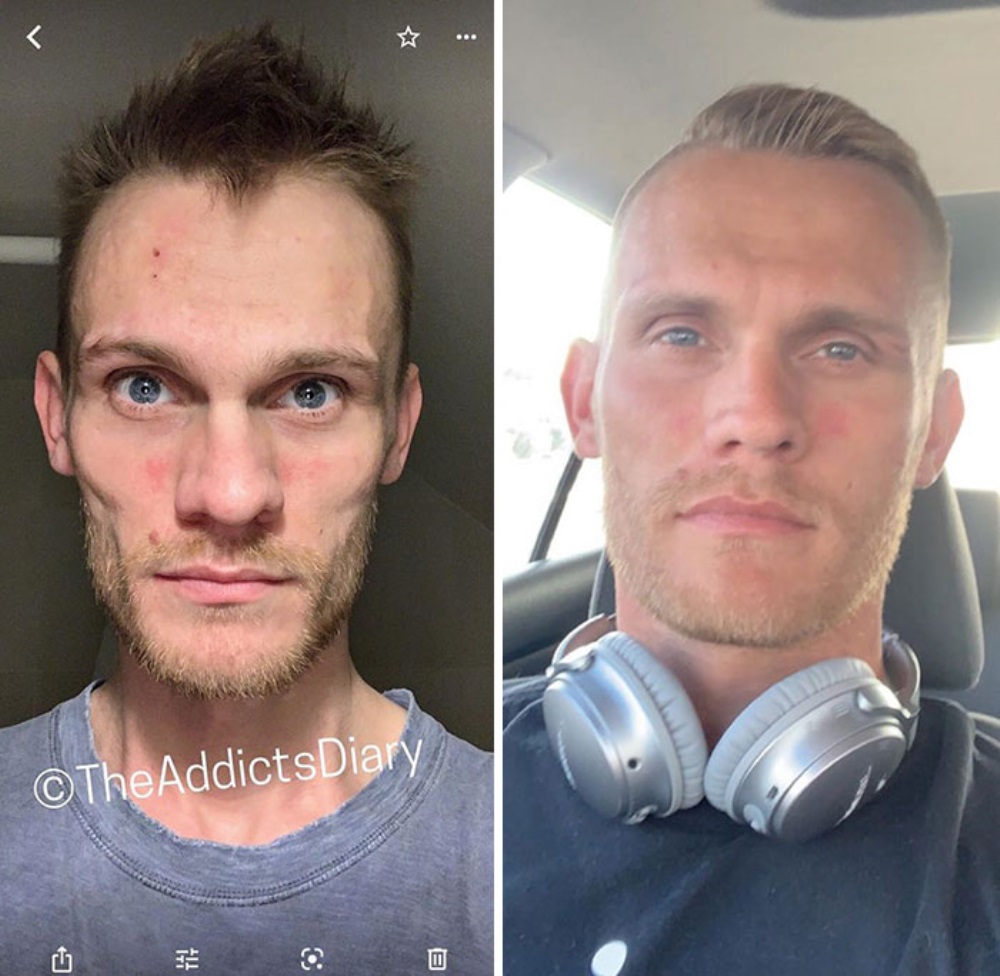 Viciado em homem branco antes e depois