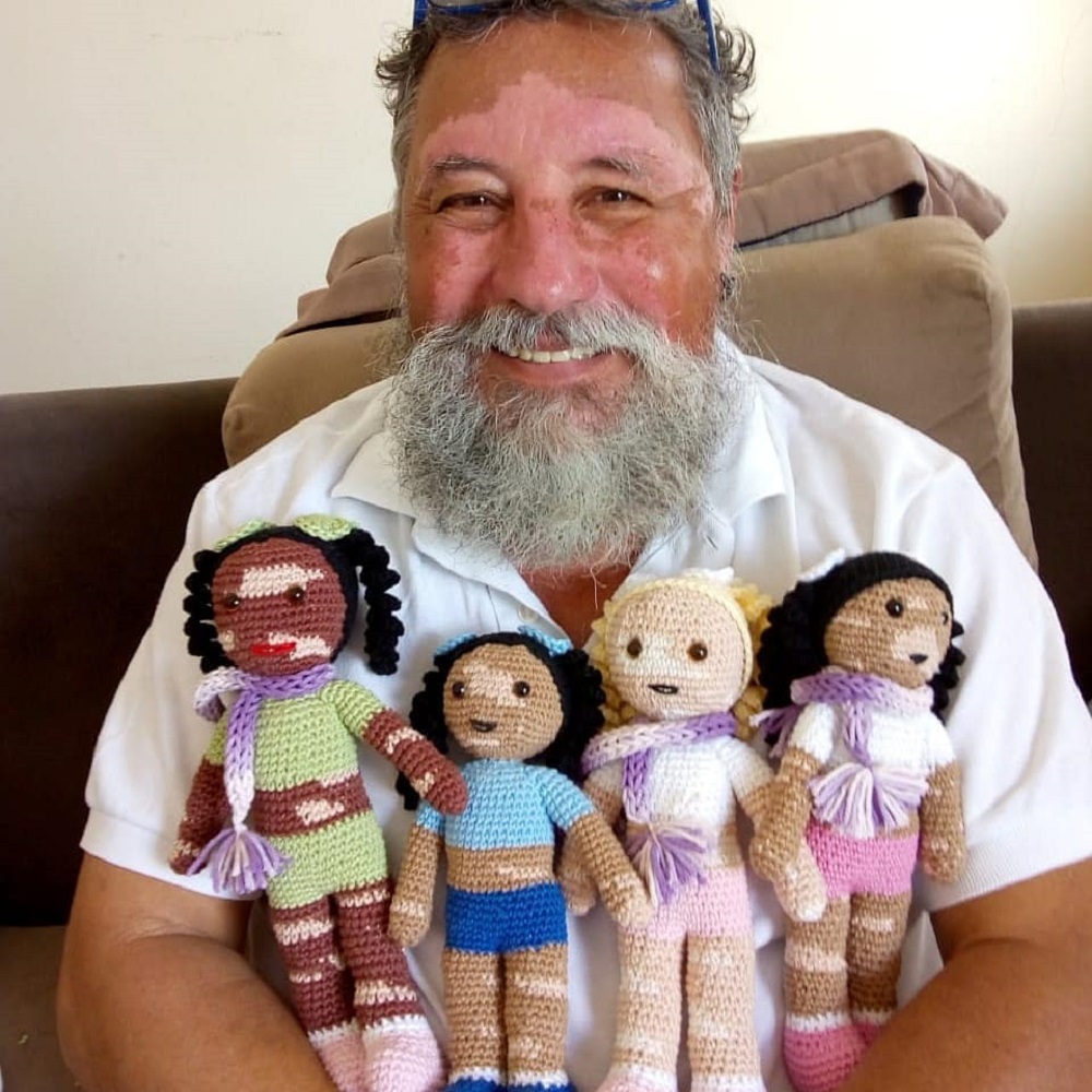 bonecas de malha com vitiligo 