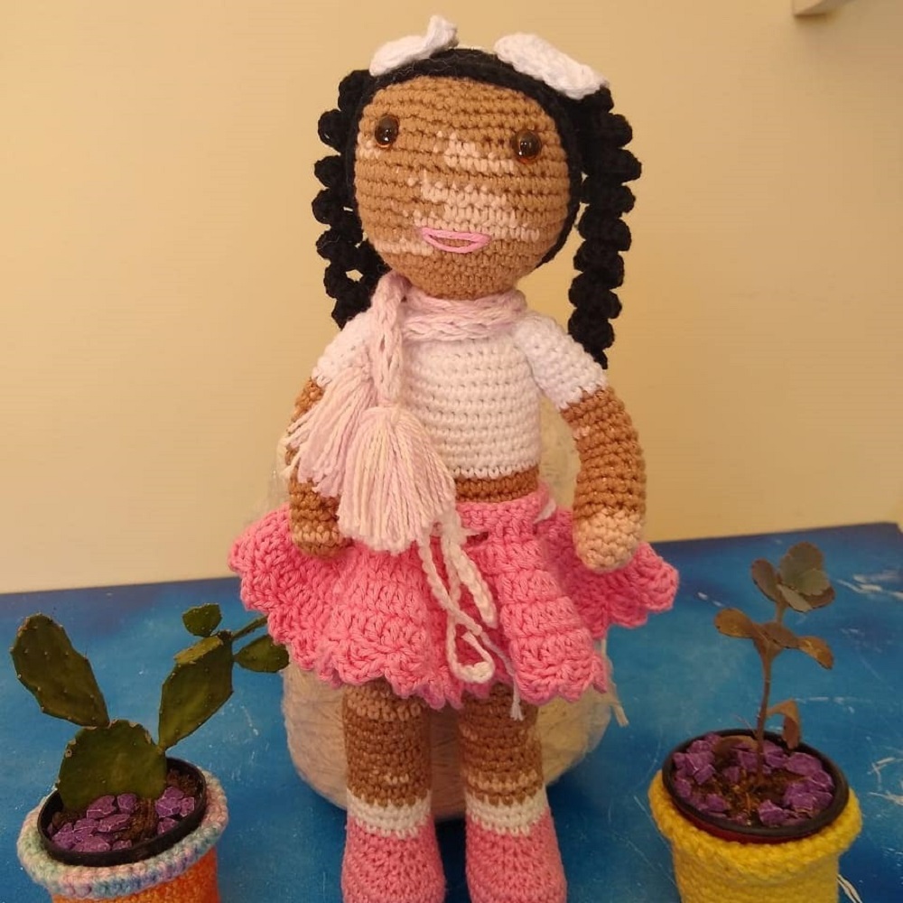 boneca com vitiligo 